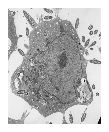 Hela細胞に感染したクロモバクテイルムIII型分泌装置の電子顕微鏡写真